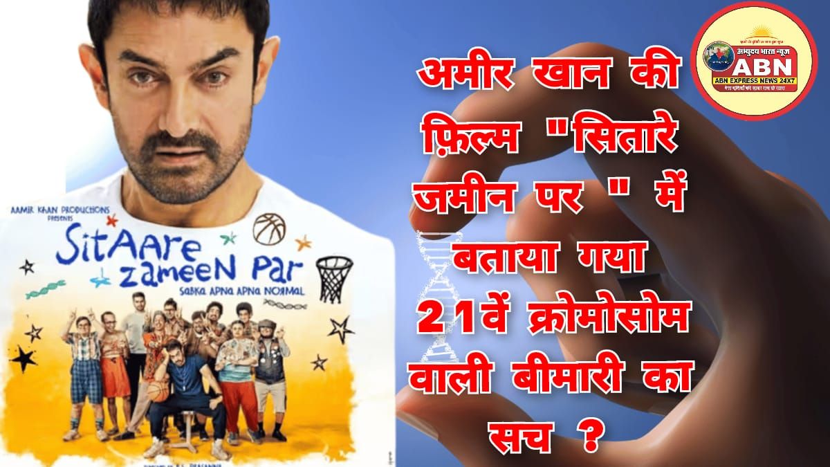 आमिर खान की फिल्म 'सितारे जमीन पर' में बताया गया 21वें क्रोमोसोम वाली बीमारी का सच....