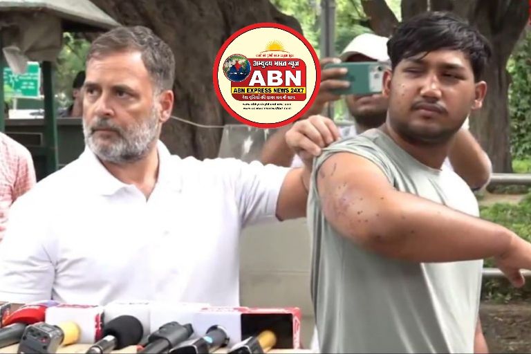 पैलेट गन से अंधे हो चुके छात्र को लेकर आये राहुल गांधी, कहा- धर्मेंद्र प्रधान एक ‘अपराधी शिक्षामंत्री’...